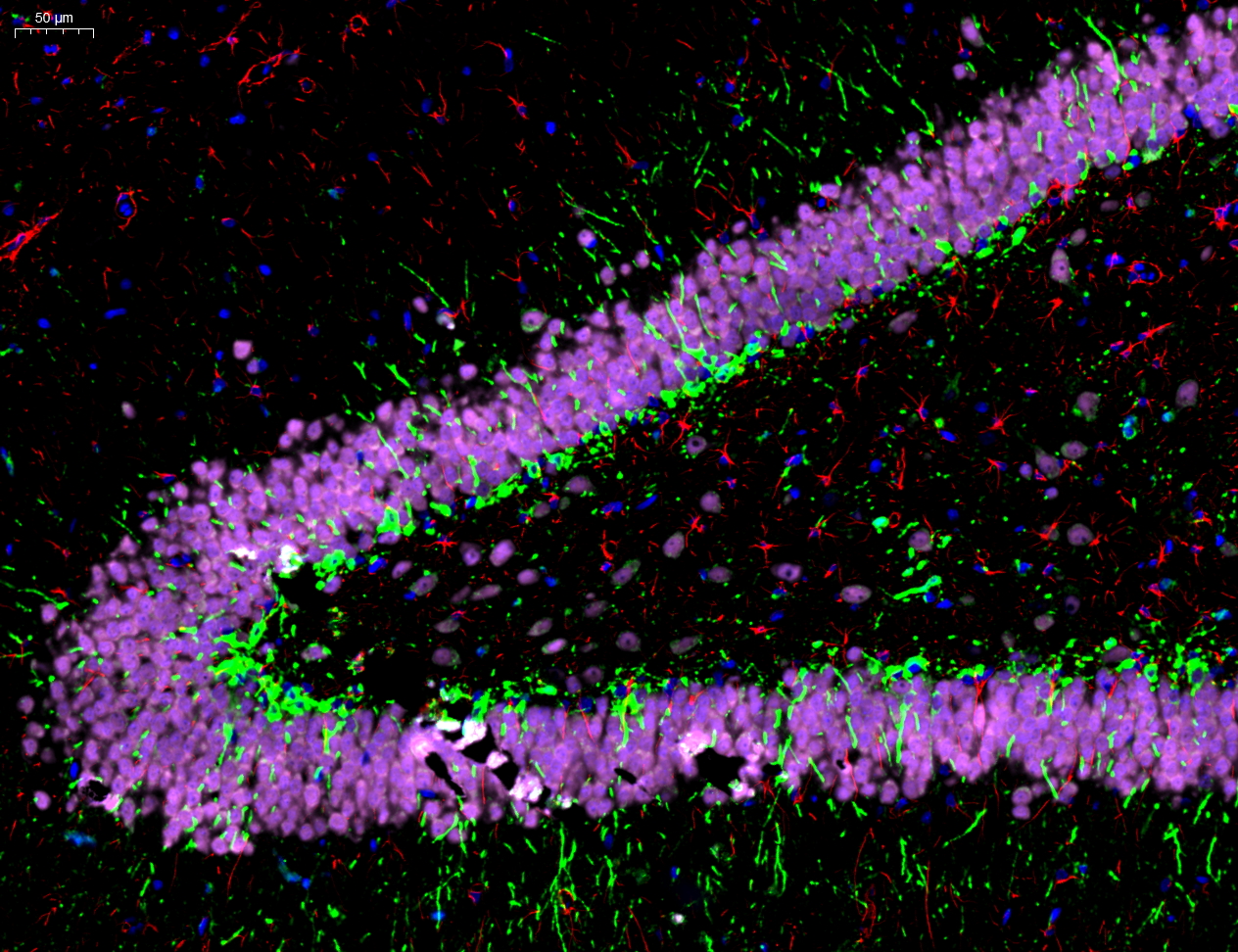 GFAP Antibody 