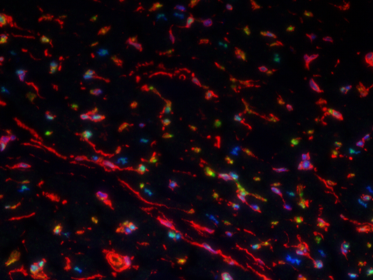 Vimentin Antibody