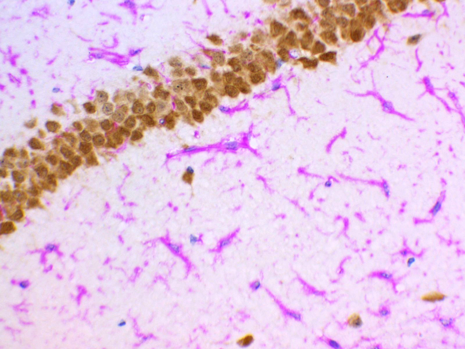 GFAP Antibody  
