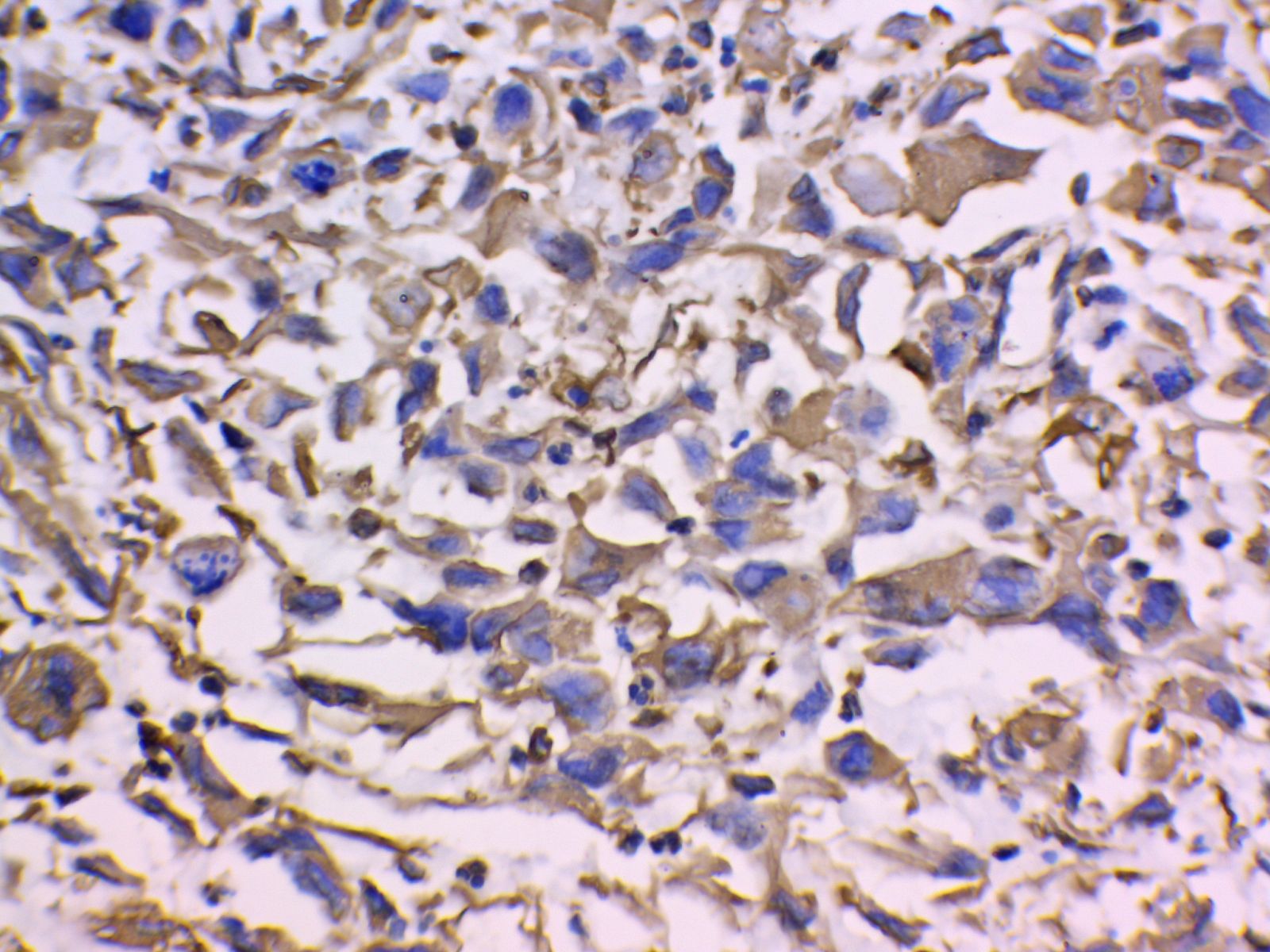 Vimentin Antibody 