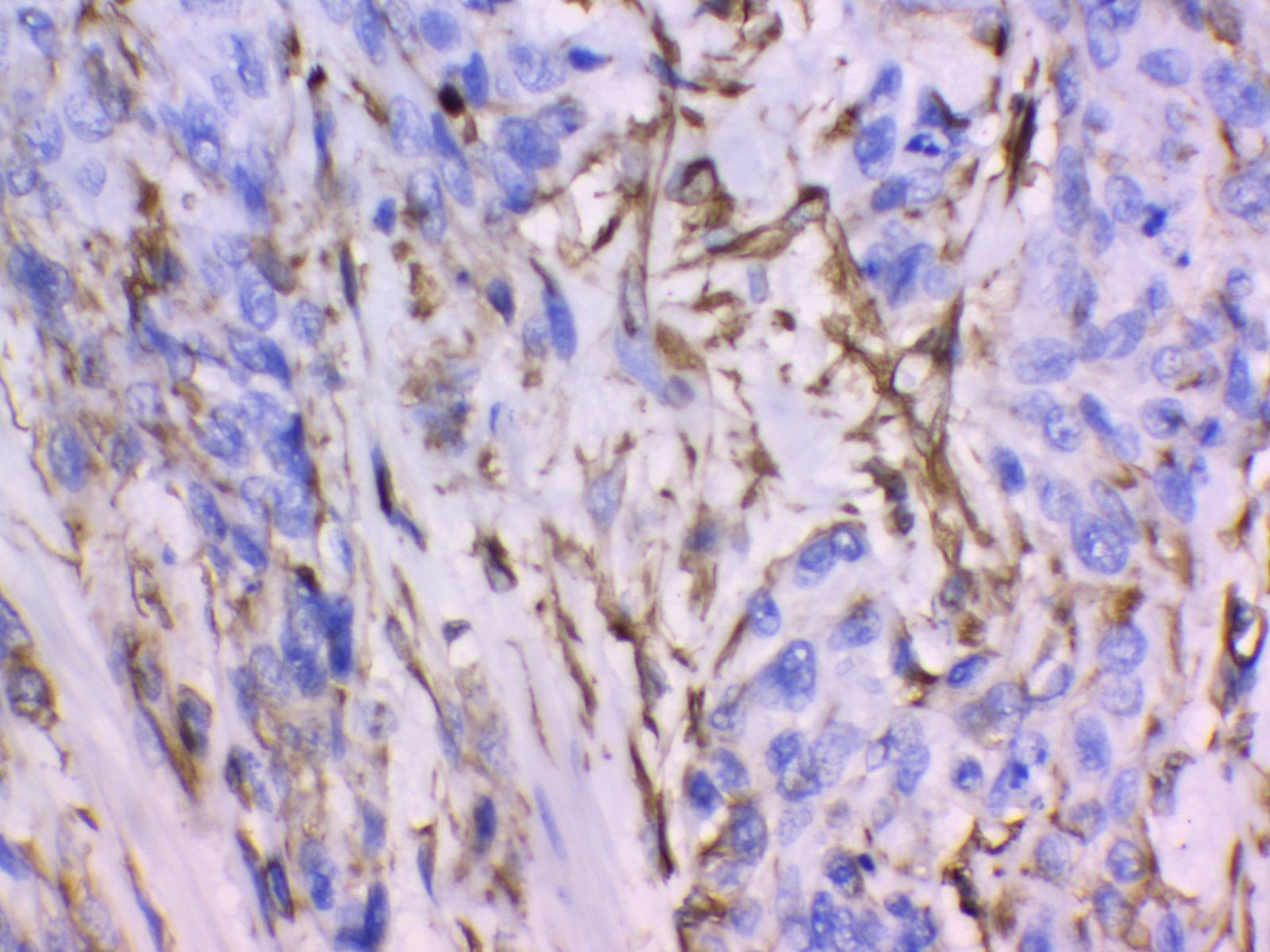 Vimentin Antibody 
