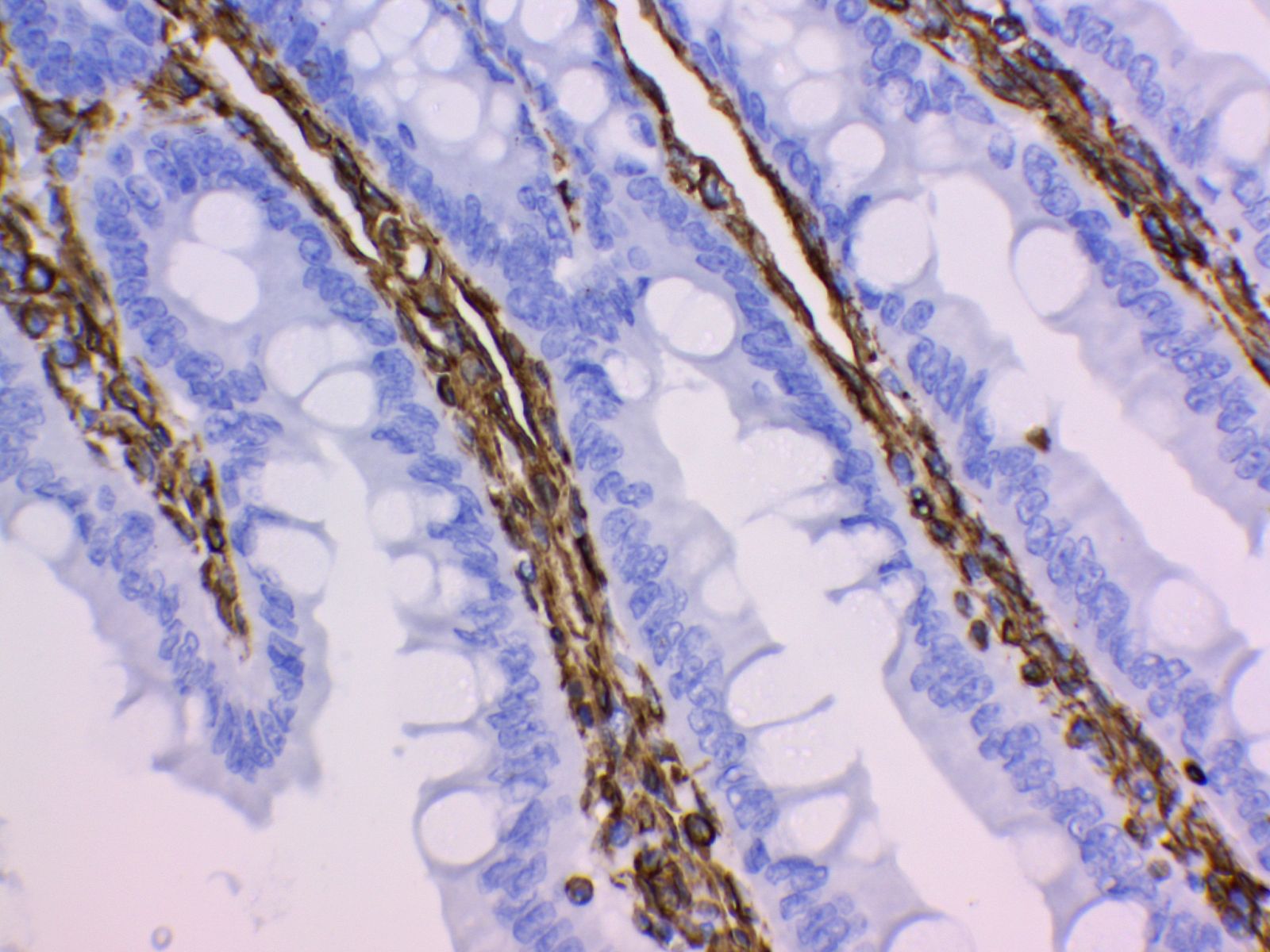 Vimentin Antibody 