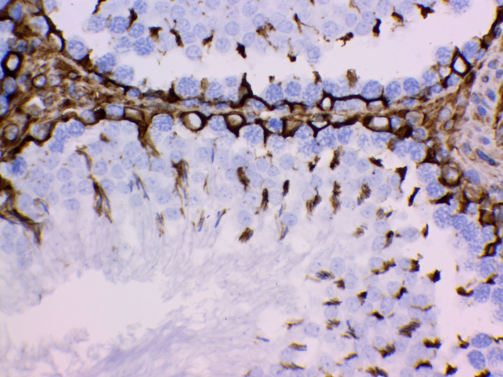 Vimentin Antibody 