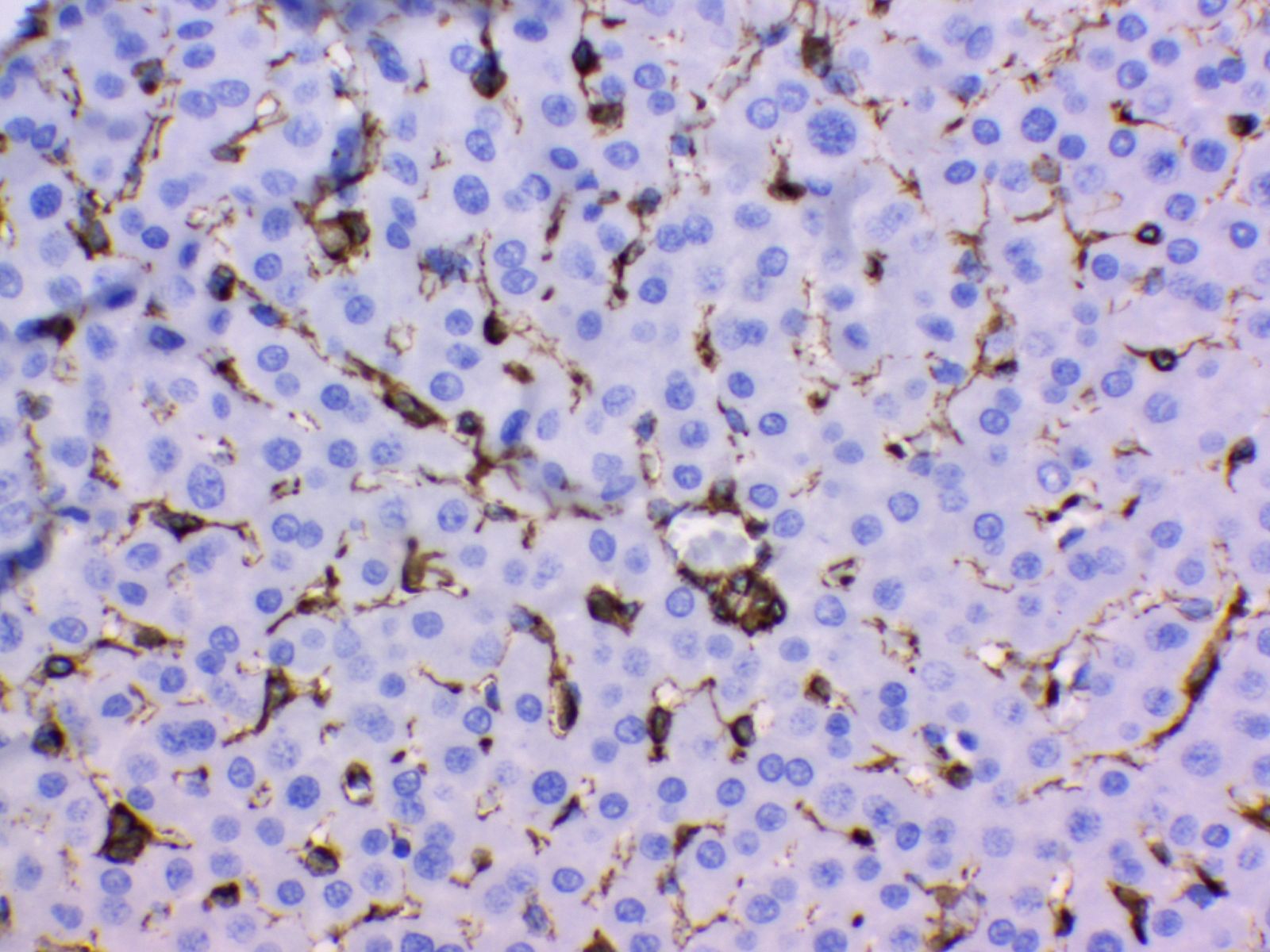 Vimentin Antibody 