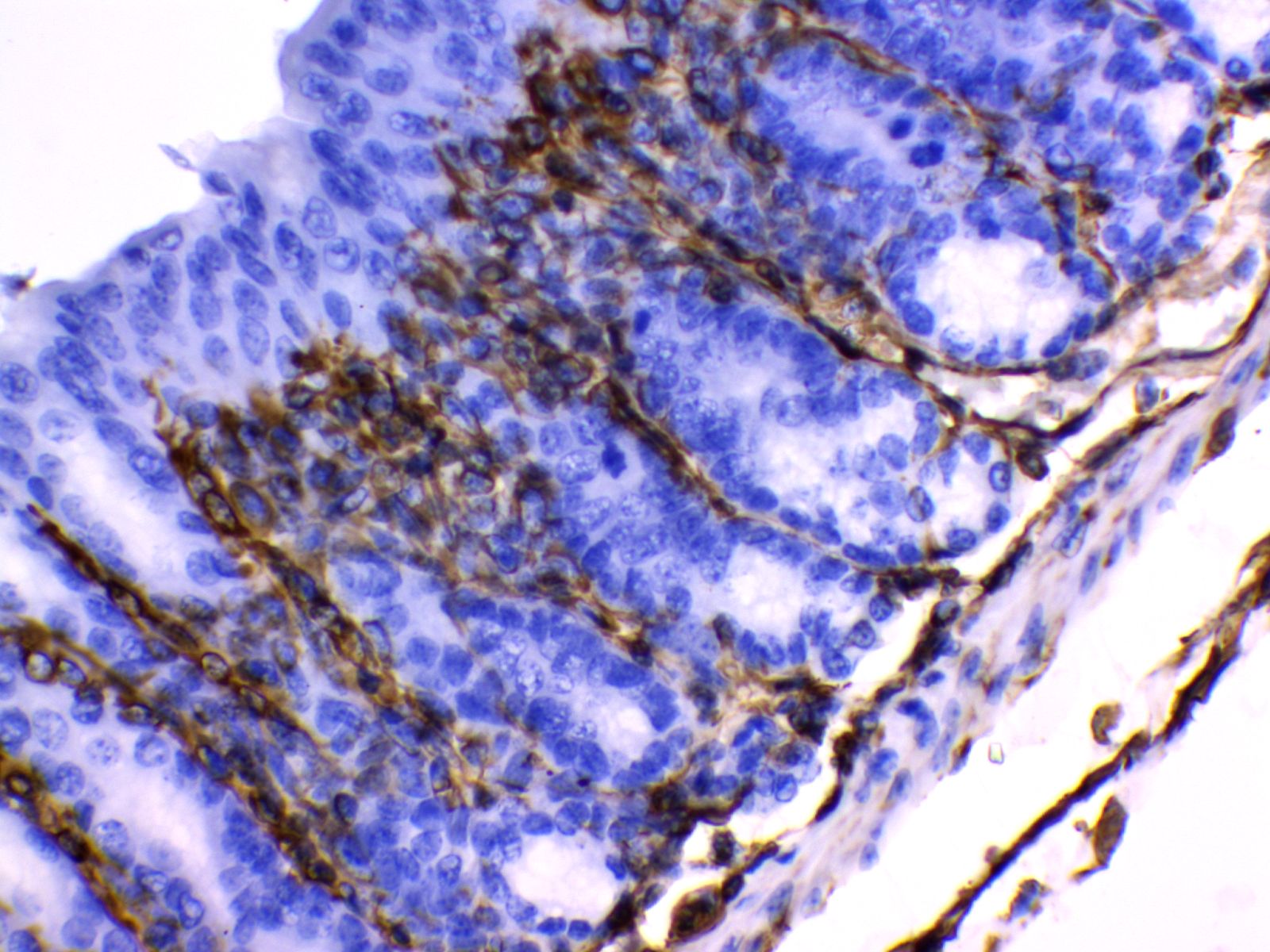 Vimentin Antibody 