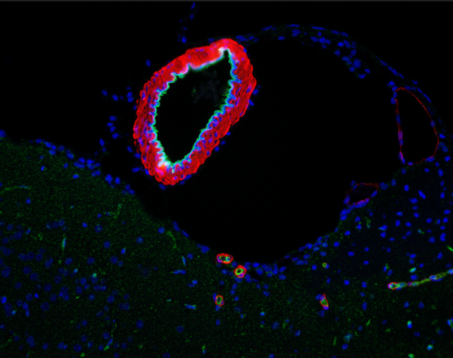 CD31 Antibody 
