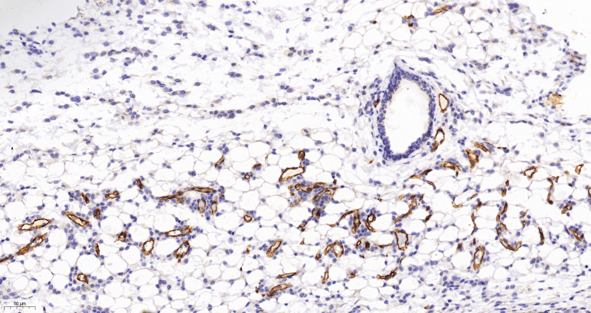 CD31 Antibody 