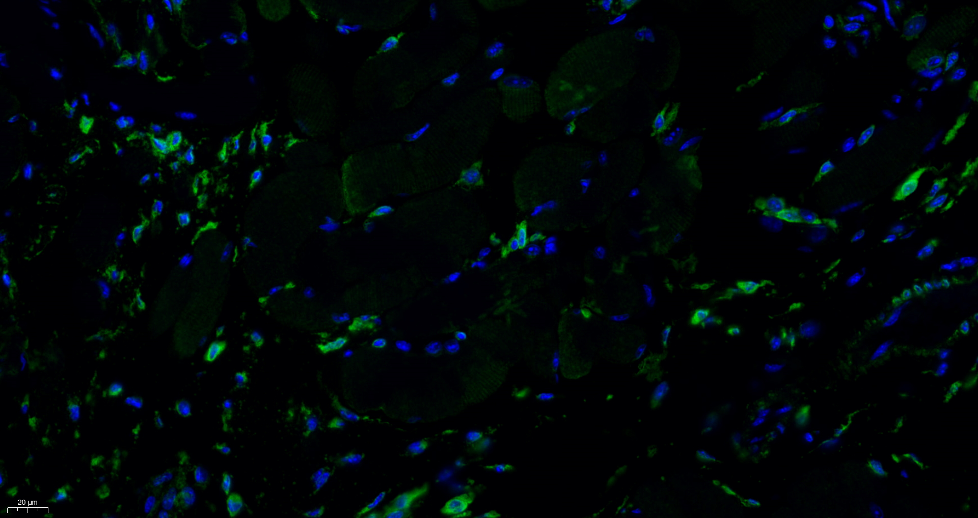 GRP78 BiP Antibody