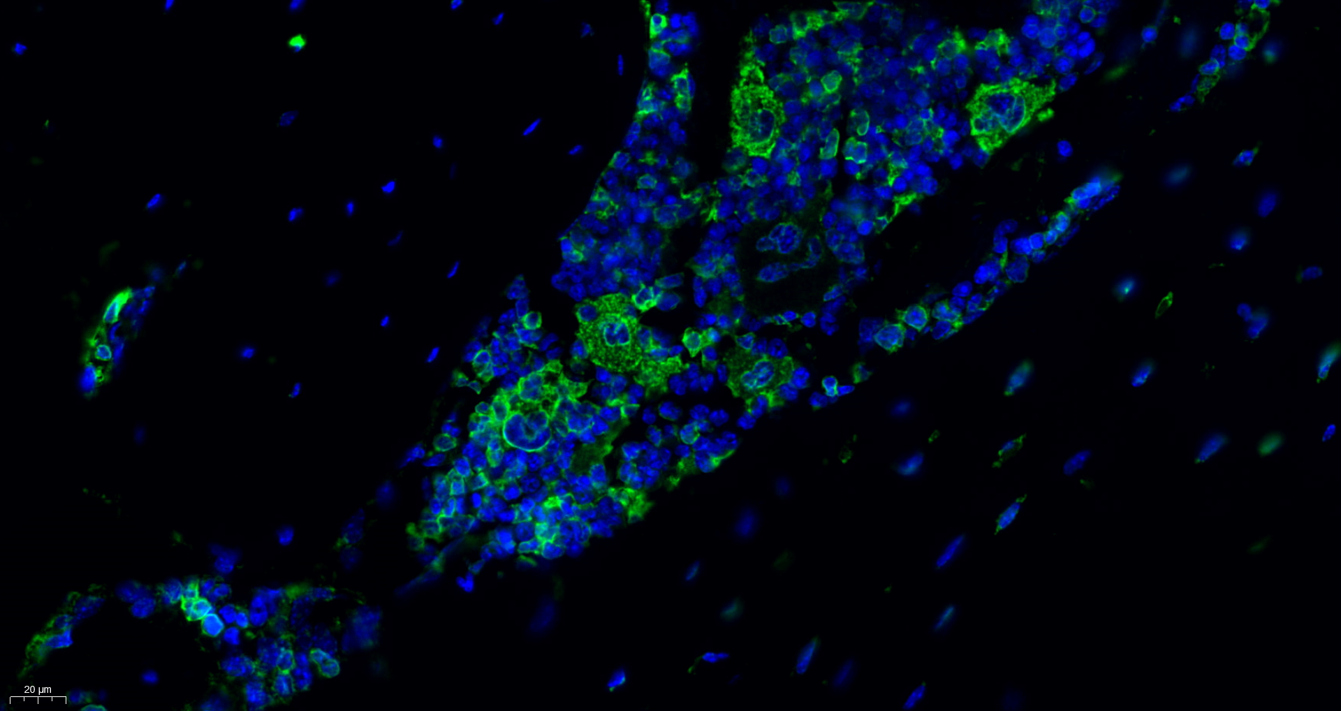 GRP78 BiP Antibody 