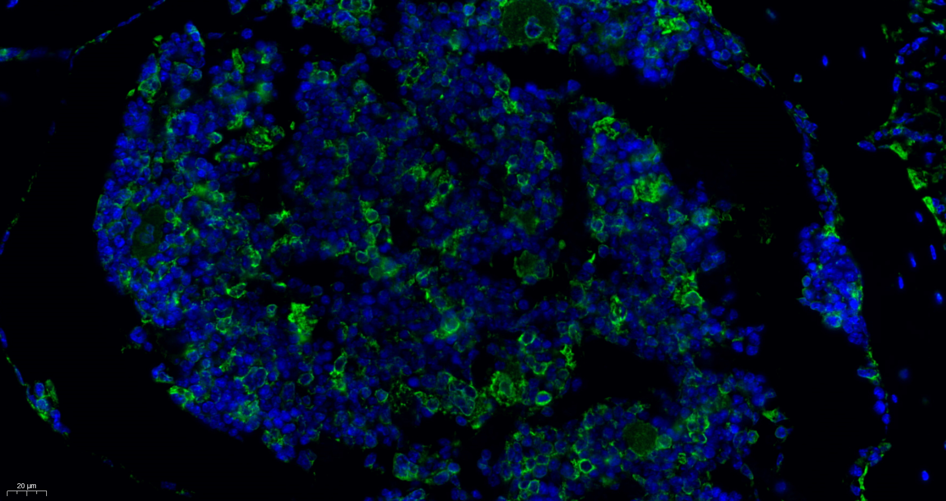 GRP78 BiP Antibody