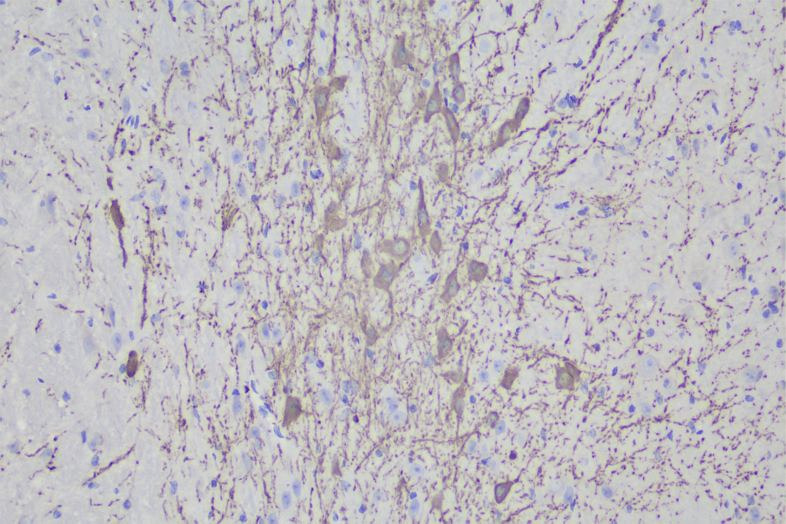 Tyrosine Hydroxylase Antibody