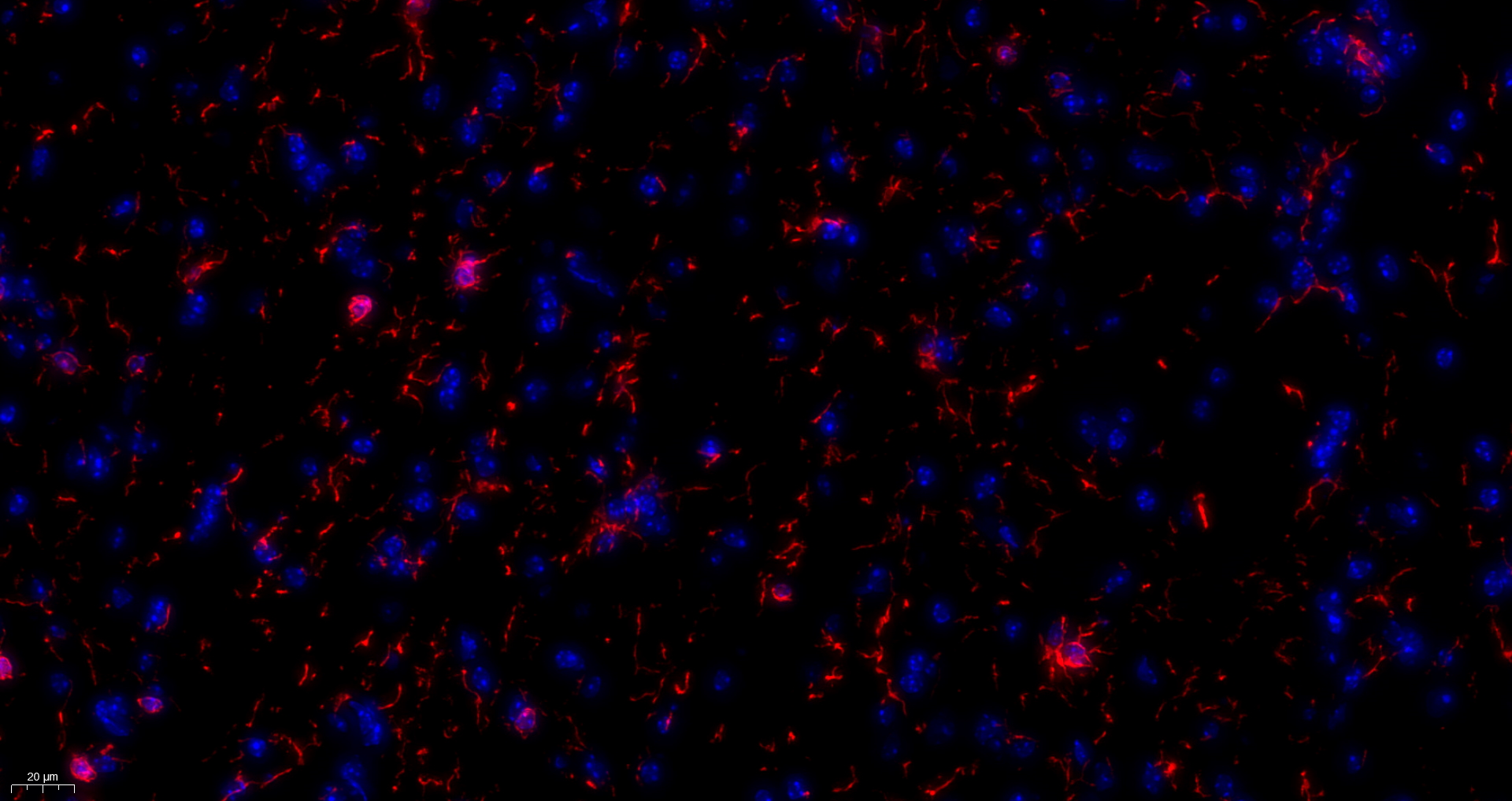IBA 1 Antibody