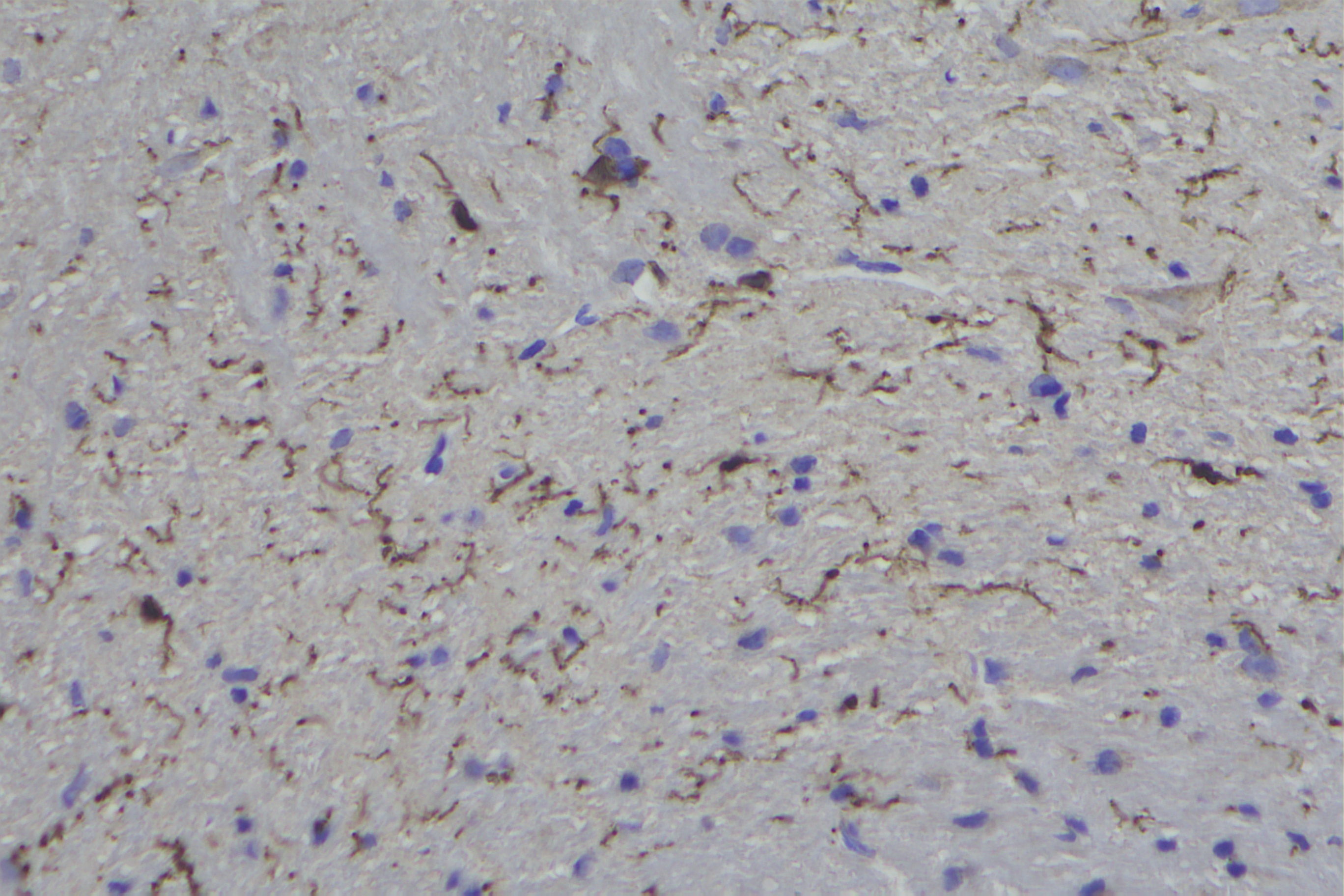 IBA 1 Antibody 