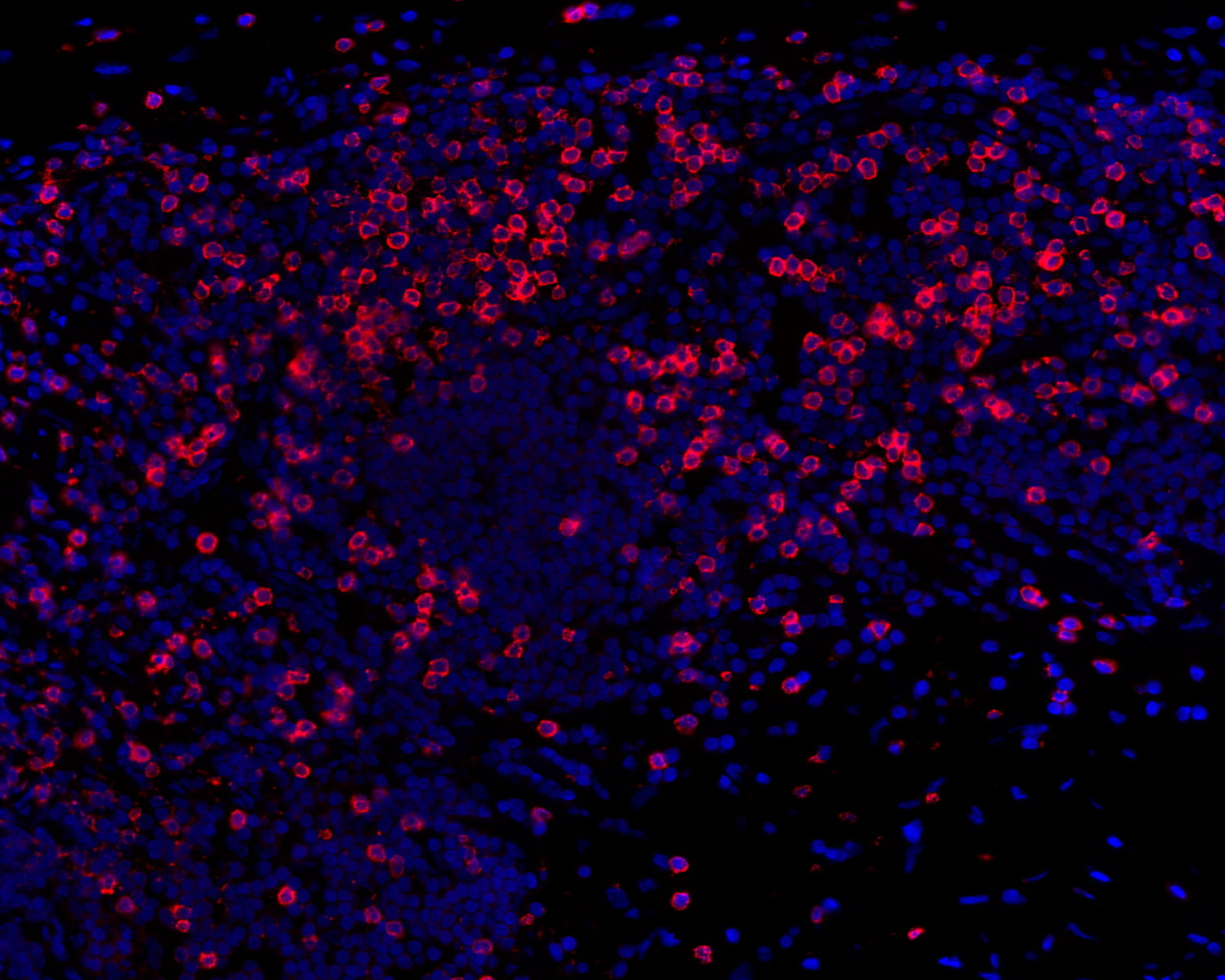 CD8 Antibody 