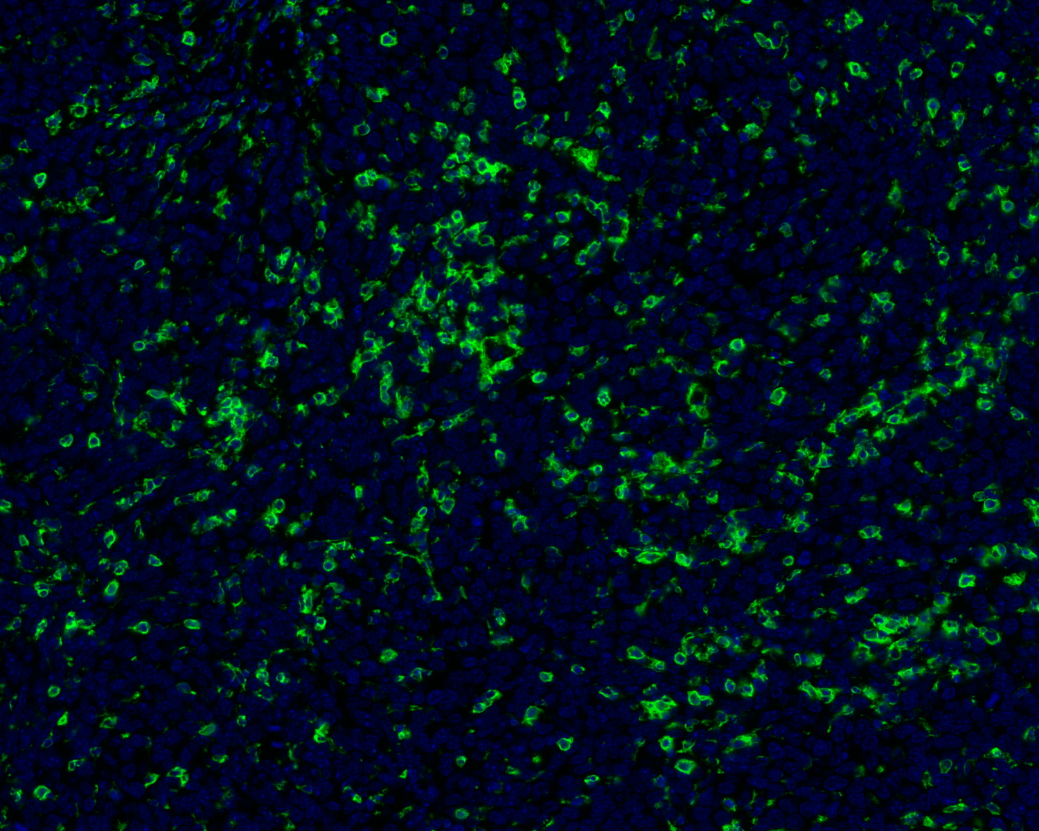 CD45 Antibody 