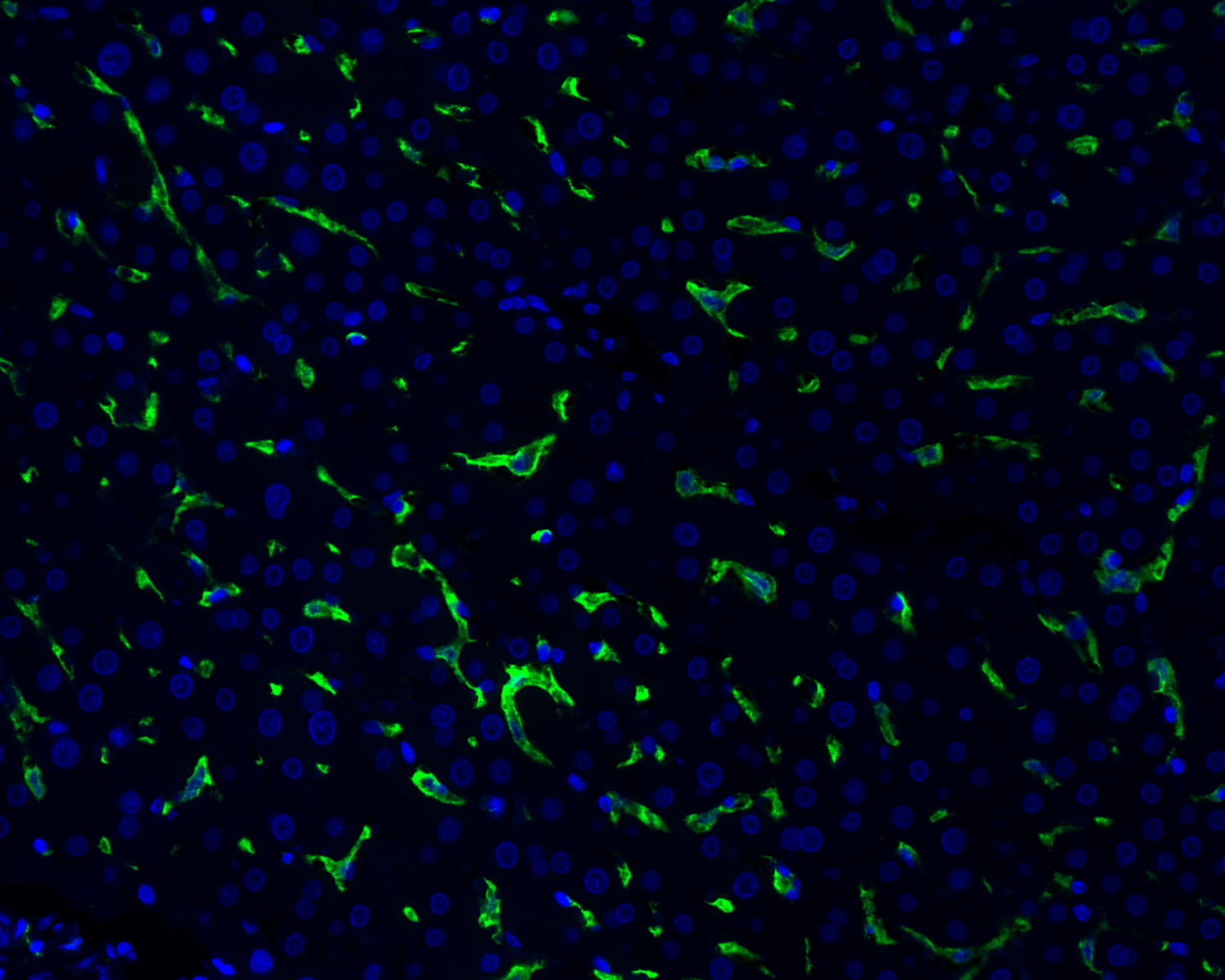 CD163 Antibody