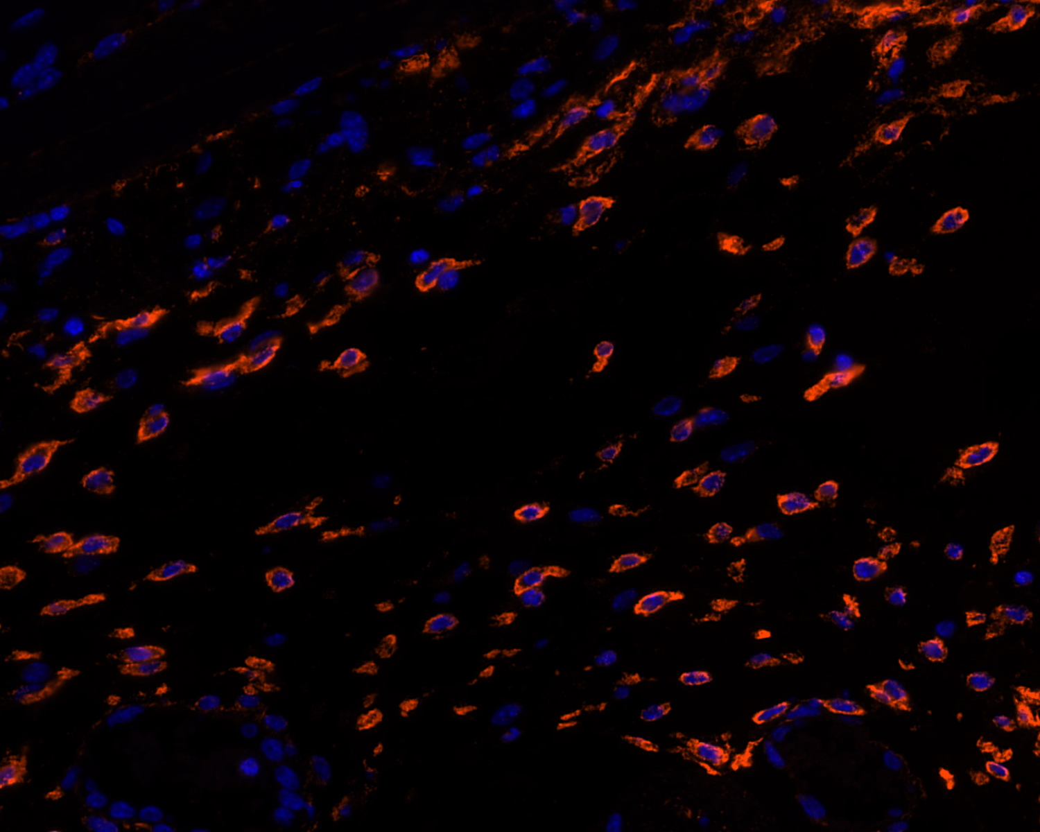MRC1 Antibody