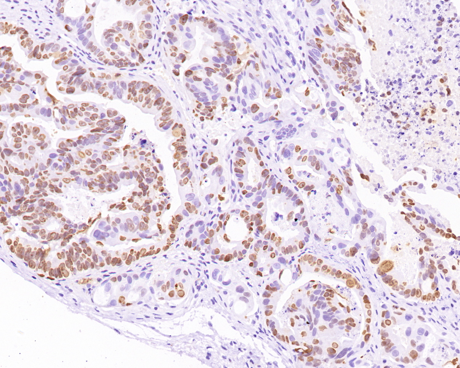 Ki67 Antibody 