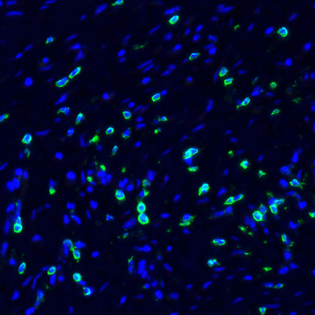 CD4 Antibody 