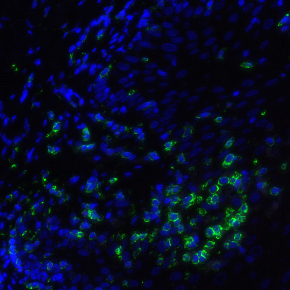 CD4 Antibody 