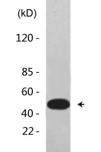 Vimentin Antibody 
