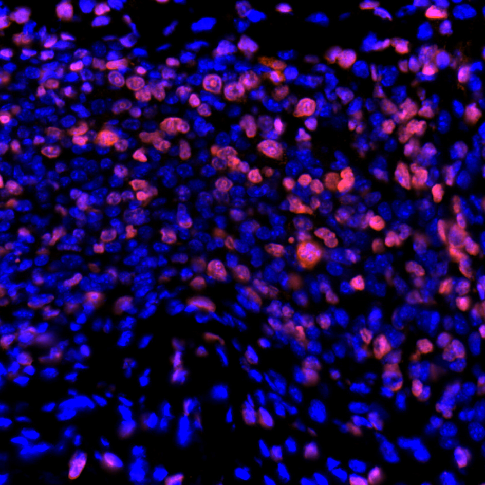 Ki67 Antibody  
