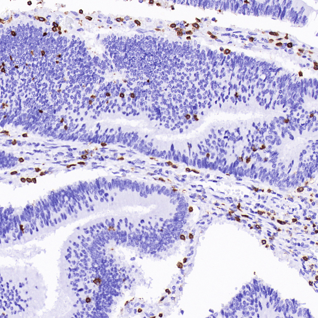 CD3 epsilon Antibody