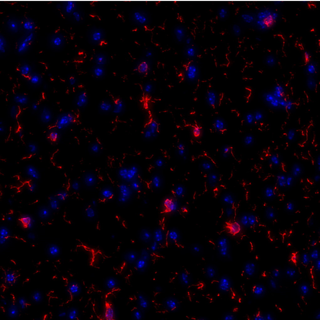 Iba-1 Antibody