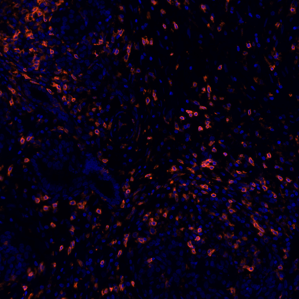 CD4 Antibody 