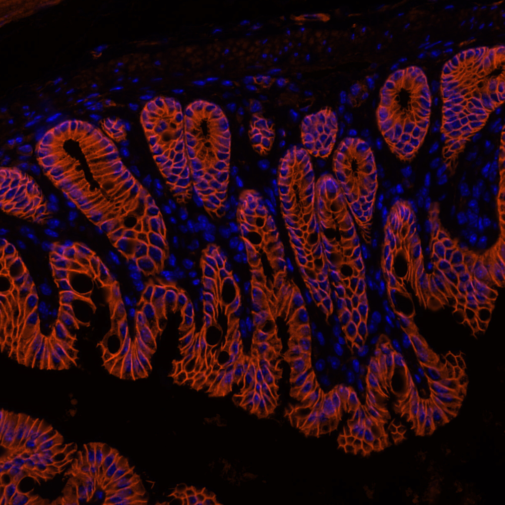 E Cadherin Antibody