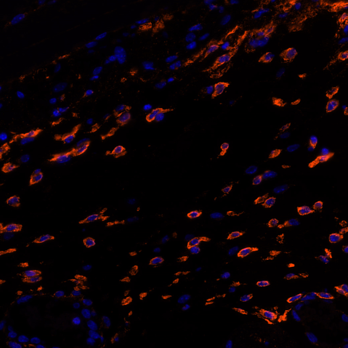 Mannose Receptor Antibody 