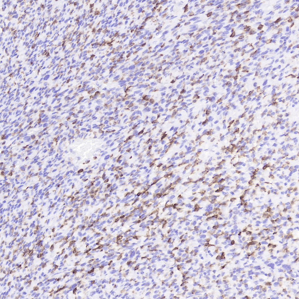 Mannose Receptor Antibody 