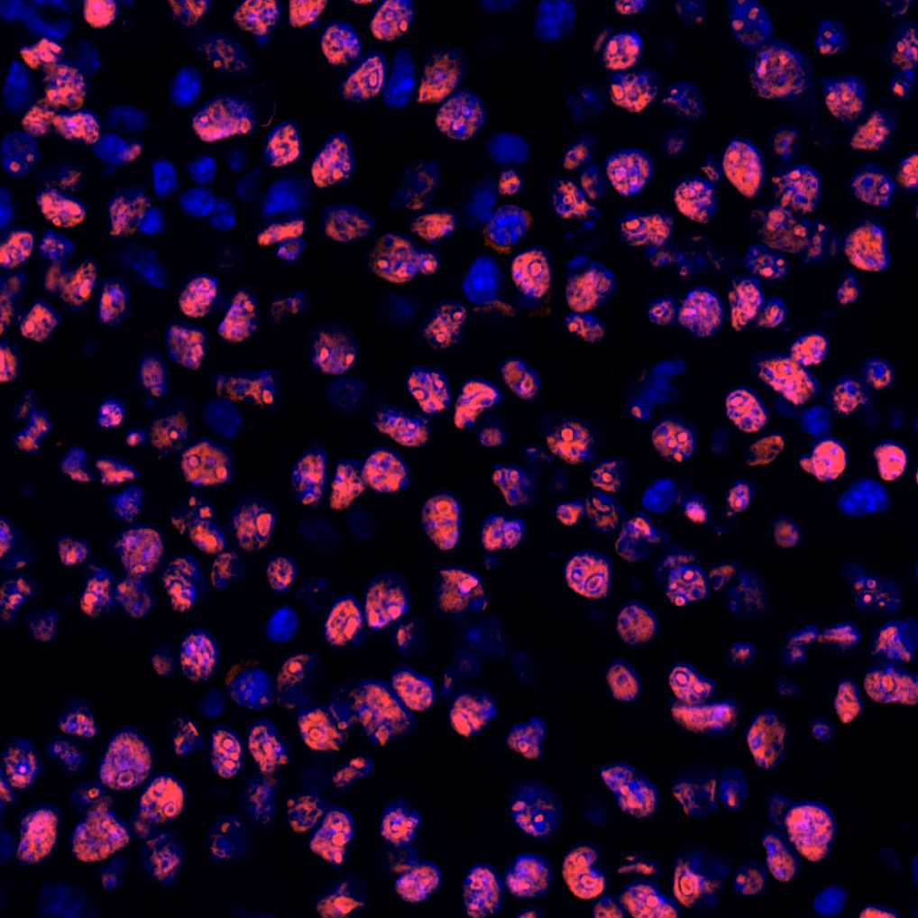 HMGB1 Antibody 