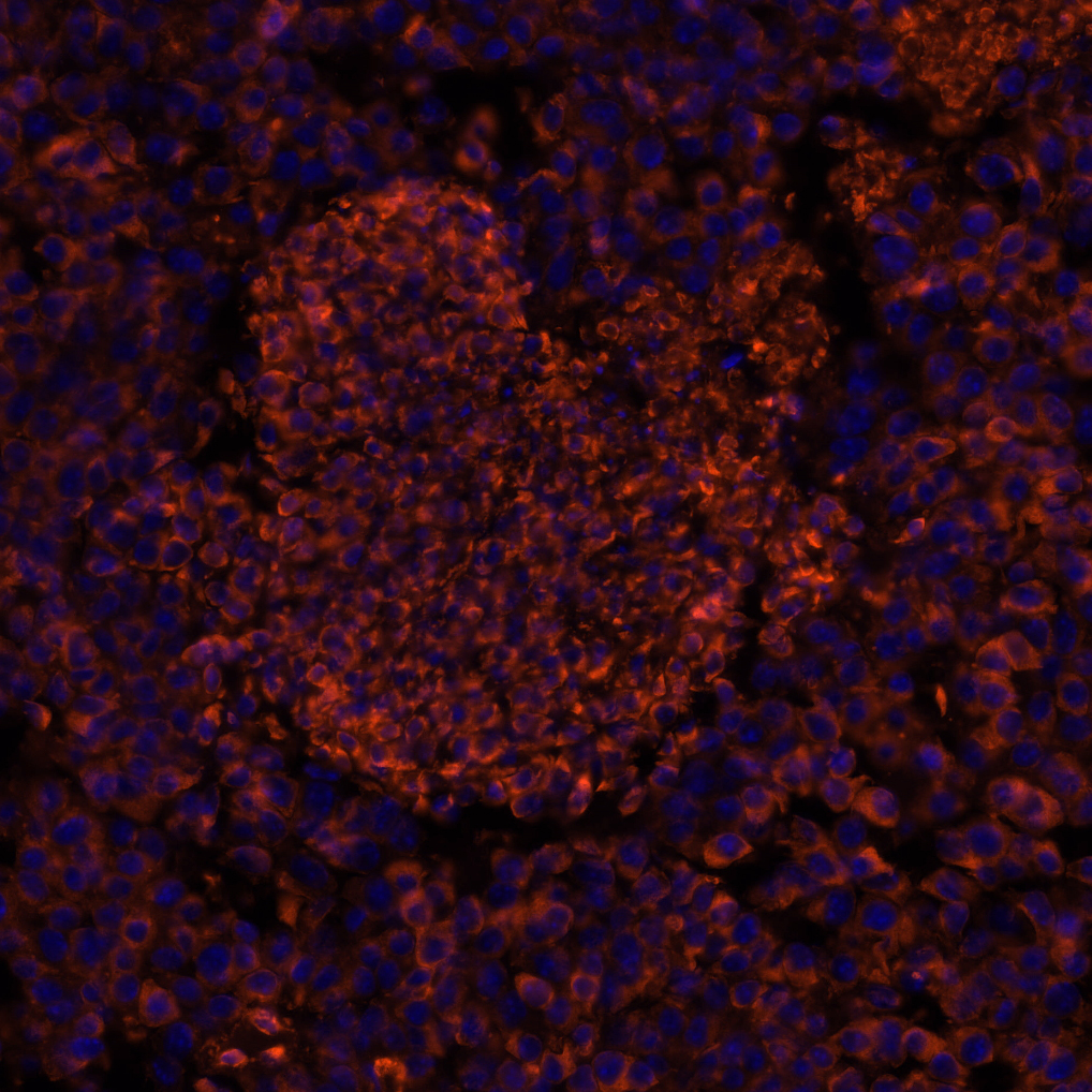Calreticulin Antibody