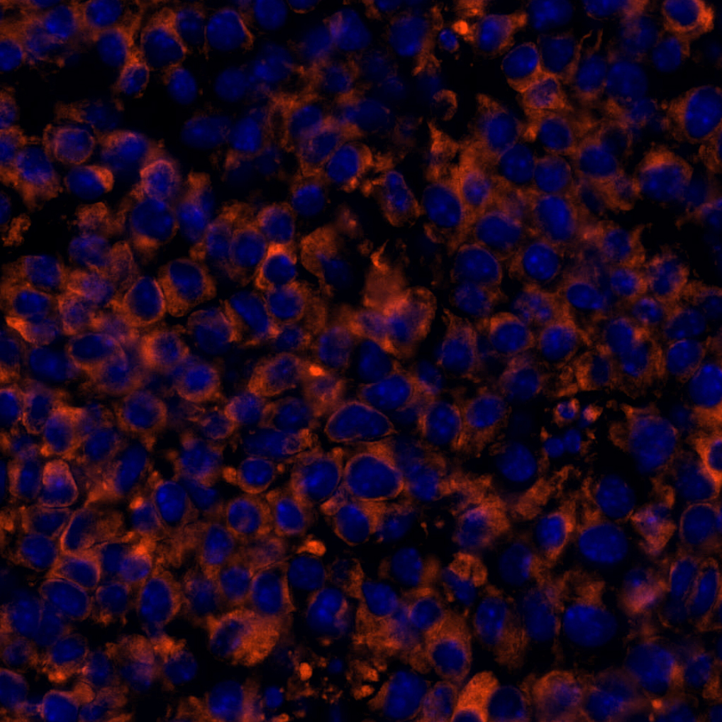 Calreticulin Antibody 