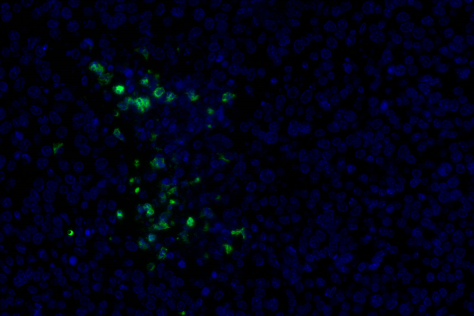 Ly-6g antibody