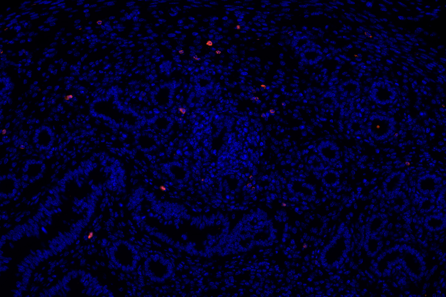 Ly-6g antibody 