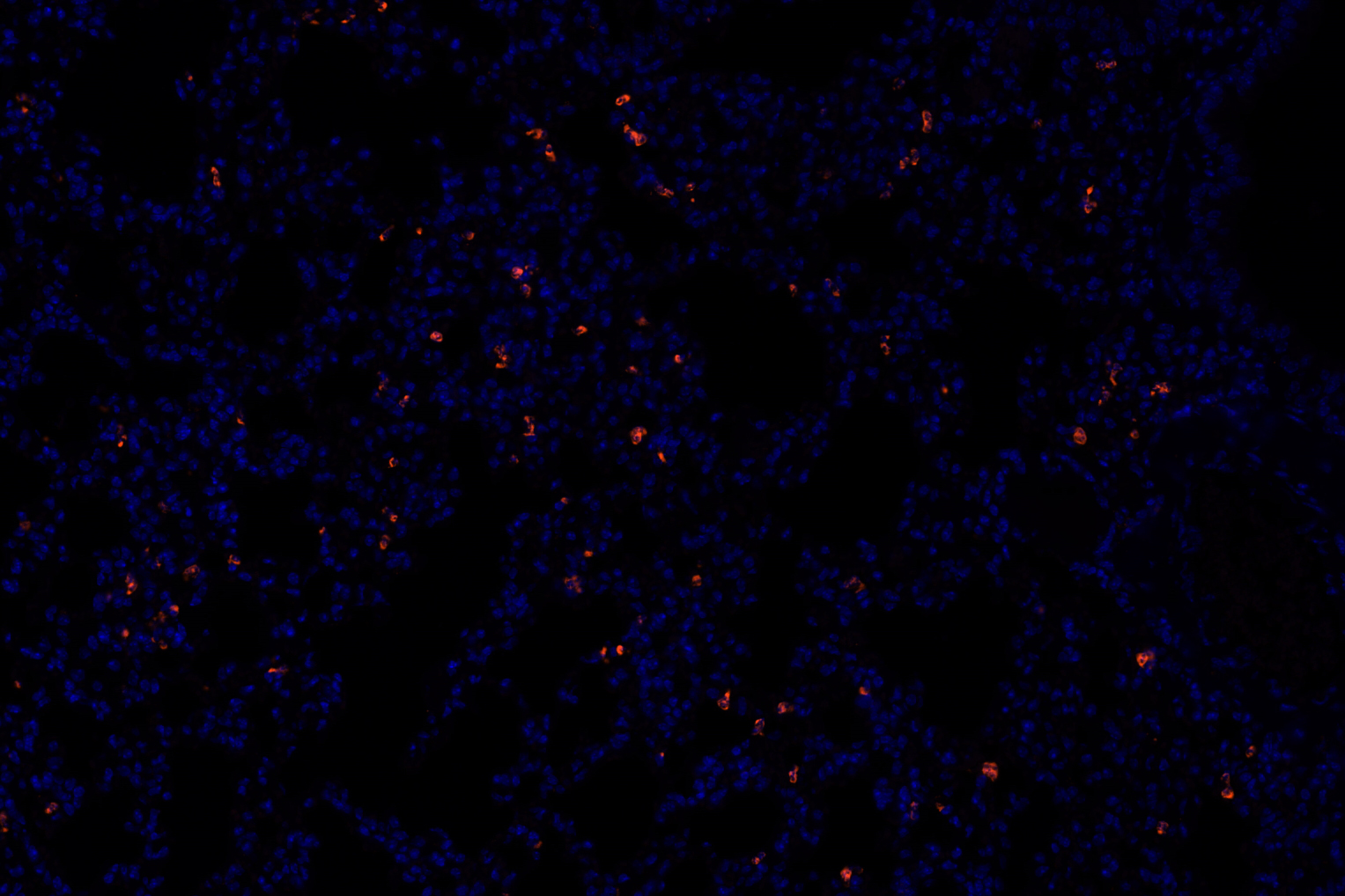 Ly-6g antibody 