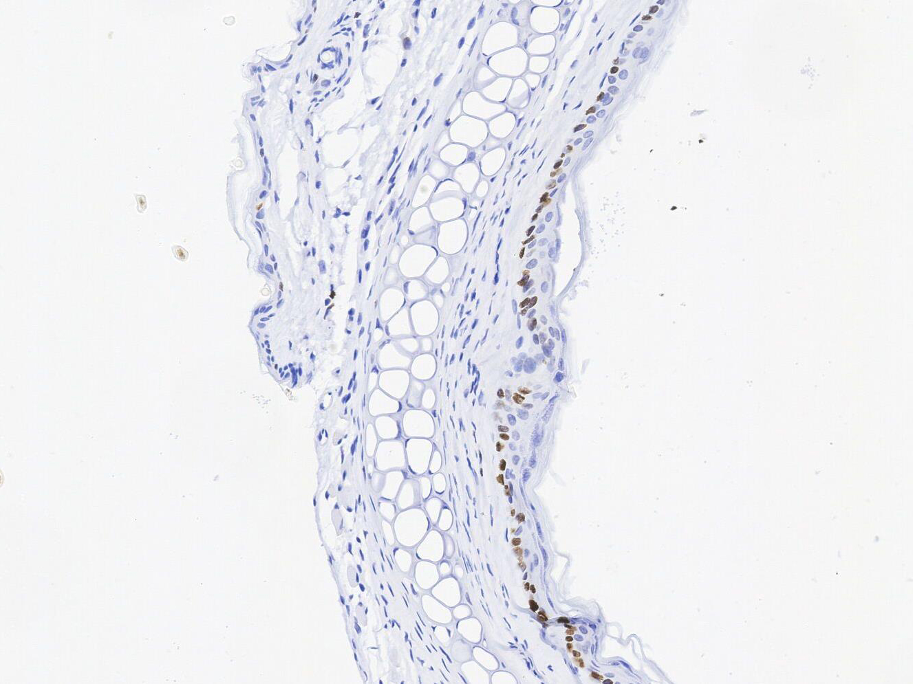 KI67 Antibody
