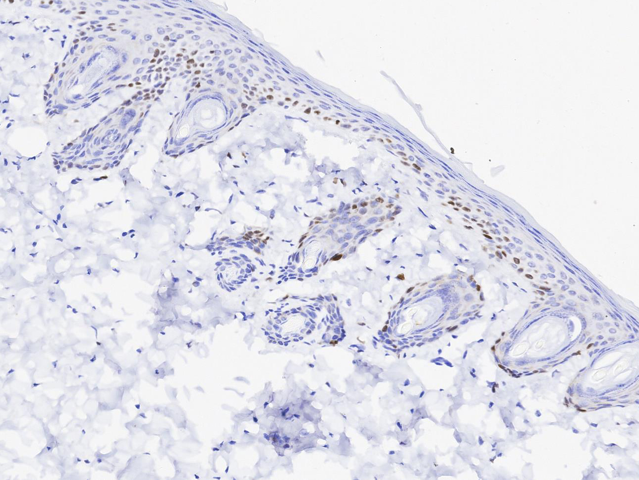 KI67 Antibody 