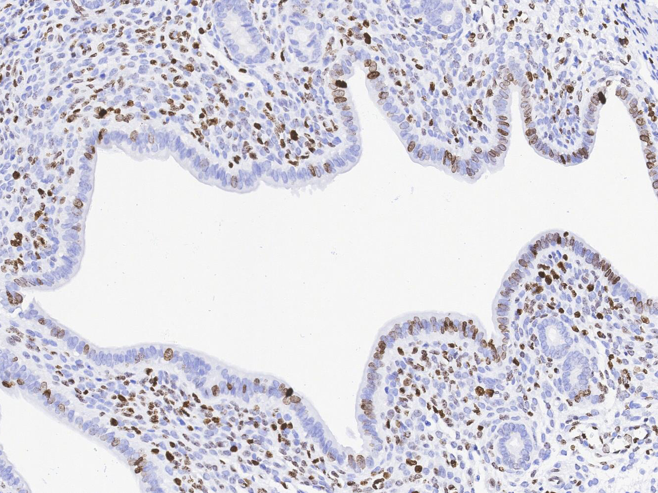 KI67 Antibody 